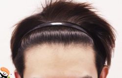 -大麦微针植发丨全国连锁