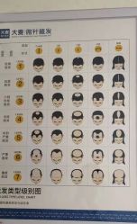 -大麦微针植发丨全国连锁