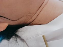 -美瑞莎创美医疗美容