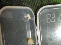 -爱贝口腔·牙周诊疗·种植修复中心