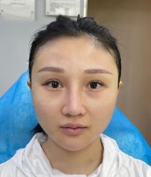点击看大图 体验前-Yestar艺星医疗美容医院