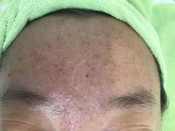 -苗医生草本科技祛痘