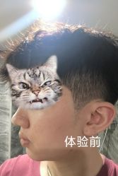 体验前-深圳美莱医疗美容医院