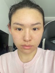 -韩辰医疗整形美容医院