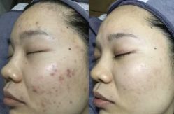 点击看大图 -智丽佳人祛斑祛痘美容美体