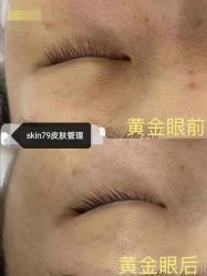 点击看大图 -skin79皮肤管理基站