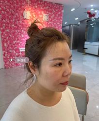 -天津健丽·去眼袋医疗美容机构