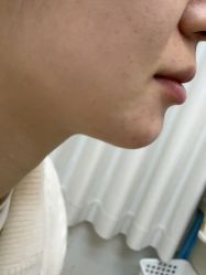 -Yestar宁波艺星整形医院