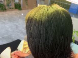 -碧莲盛·不剃发植发