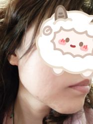 体验后-坤如玛丽·医疗美容中心