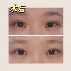 -素美医疗美容·西南眼鼻整形·修复基地