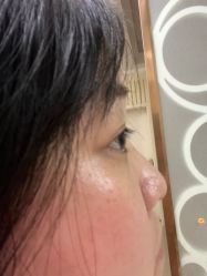 体验后-安徽合肥韩美整形外科医院