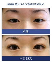 -丰联丽格医疗美容·联合丽格眼整形中心