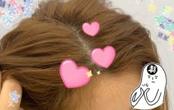 -大麦微针植发全国连锁