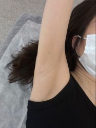 -MUSES专业脱毛比基尼サロン日式连锁