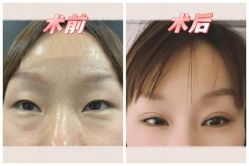 -素美医疗美容·西南眼鼻整形·修复基地
