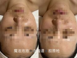 -LUNA皮相美·骨相美高级美感