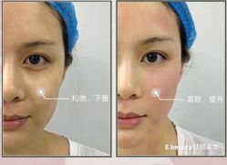 -E.beauty驻颜·痘敏肌调理中心