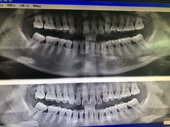 -天使口腔门诊部(上海店)