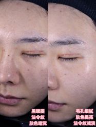 -Yestar重庆艺星医疗美容医院