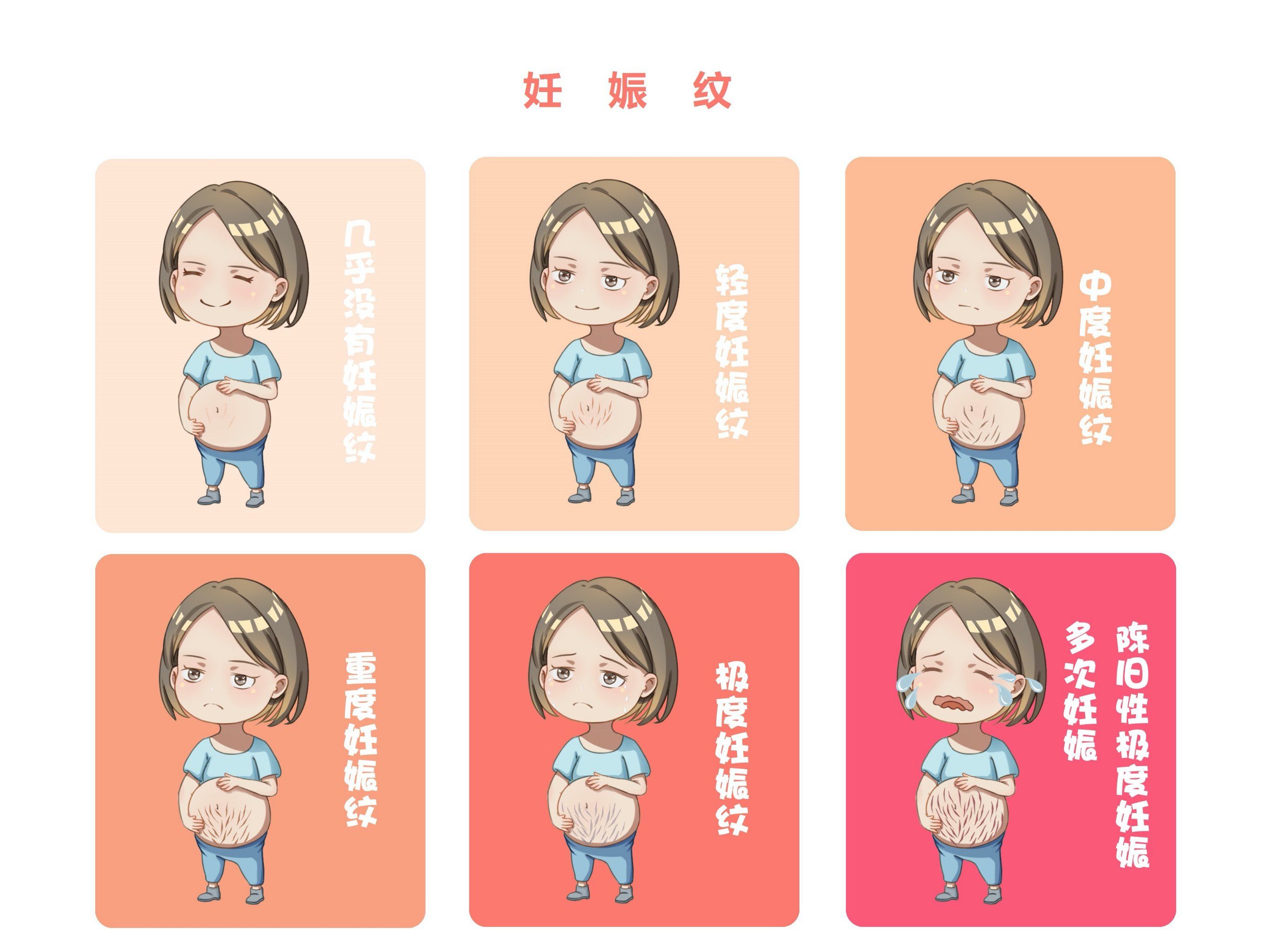 妊娠纹
