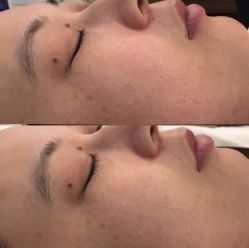 -Yukina Plus专业日式美肌