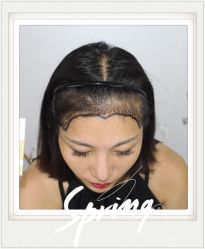 -大麦微针植发全国连锁