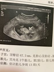 -上海美兰湖妇产科医院