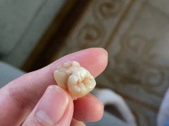 -浙江大学医学院附属第一医院(庆春院区)