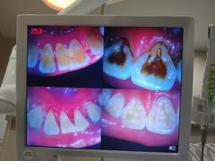 -土豆口腔(凤凰北总店)