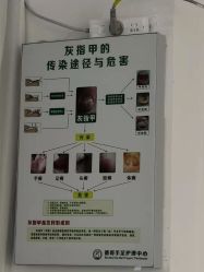 -德哥灰指甲脚气甲沟炎跖疣护理