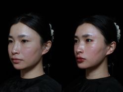 点击看大图 -Yestar艺星整形美容医院