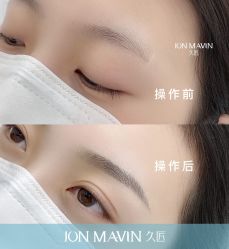 -久匠半永久纹眉