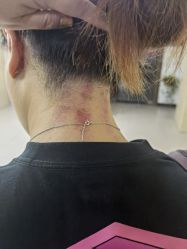 -痣斑堂·取大痣