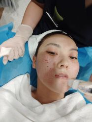 -More摩尔医美の注射线雕光电中心