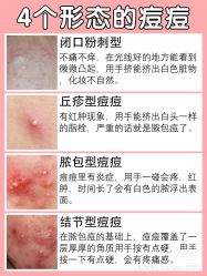 -Cream88颜皮肤管理中心