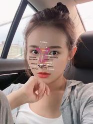 -北京米扬丽格医疗美容·联合丽格鼻整形中心