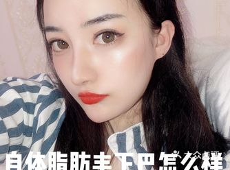 所以很多医院跟你说，需要填充2到3次