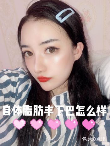 所以很多医院跟你说,需要填充2到3次