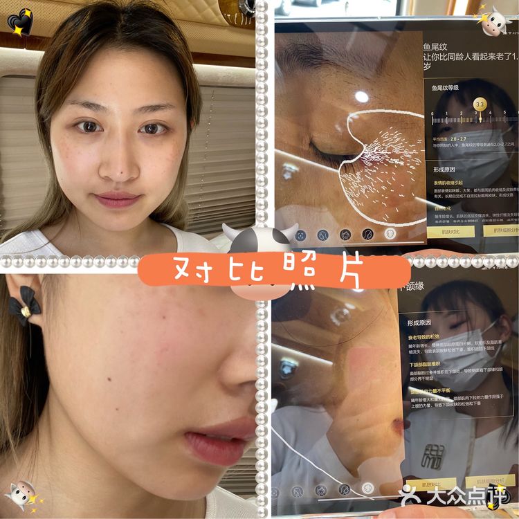 定制美容仪~
