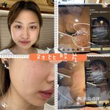 定制美容仪～