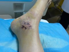 -成都市第一人民医院(南区)