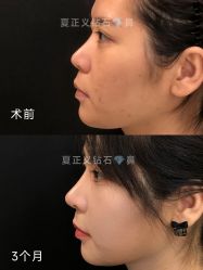 -北京米扬丽格医疗美容·联合丽格鼻整形中心