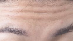 -北京米扬丽格医疗美容·联合丽格鼻整形中心