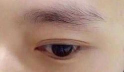 哈尔滨伊美尔医疗美容医院-伊美尔医疗美容医院