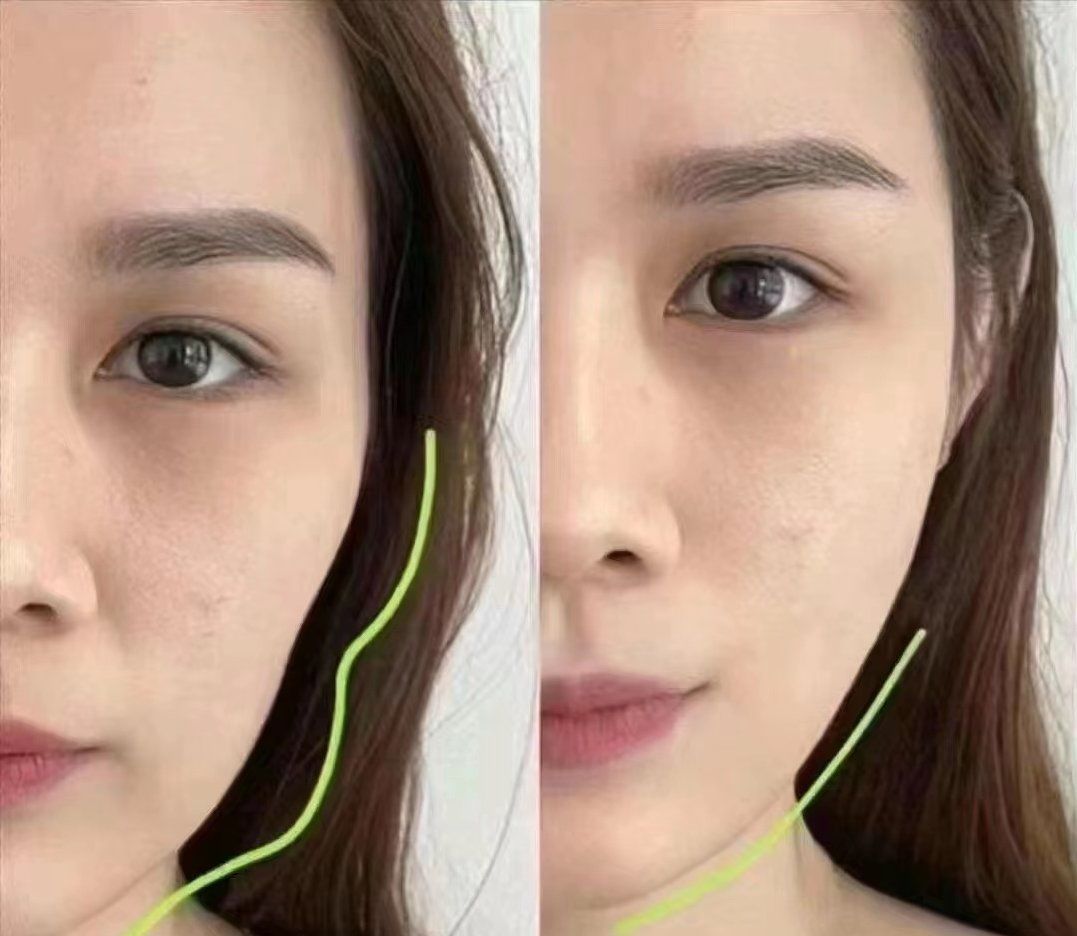 面部整形的手术方法有哪些