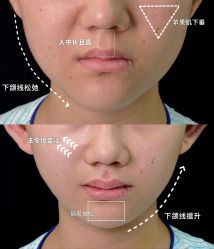 点击看大图 -欧兔博士·O2BOX微高压氧舱