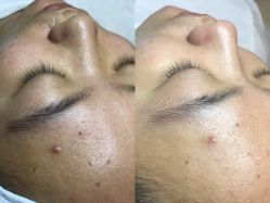 -Hi Beauty Skin 科技美肤中心