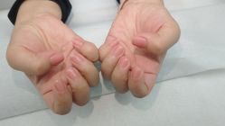 -赢韵美甲美睫瑞士净斑中心