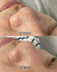 -美肤盾祛痘·问题肌头疗管理中心